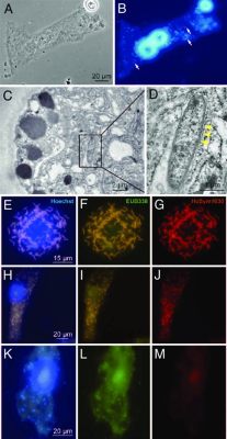 Dientamoeba! A Microscopic Marvel Exhibiting Remarkable Endosymbiotic Relationships With Bacteria