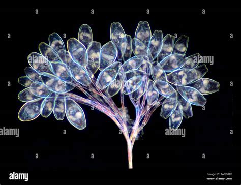 Heterotrichous Ciliates!  Tiny Single-Celled Organisms Exhibiting Striking Diversity in Shape and Locomotion