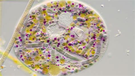  Heterotrichs:  Single-celled Ciliates with Complex Structures that Dance Across Freshwater Environments!